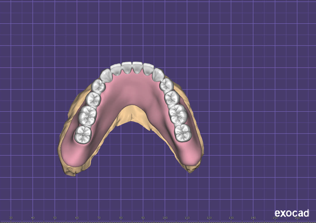 Рабочий процесс в 3Shape и exocad · 4/8