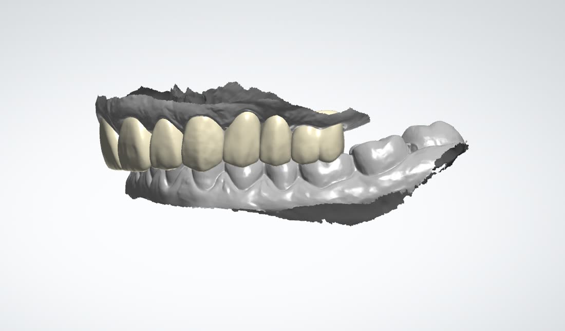 Рабочий процесс в 3Shape и exocad · 7/8